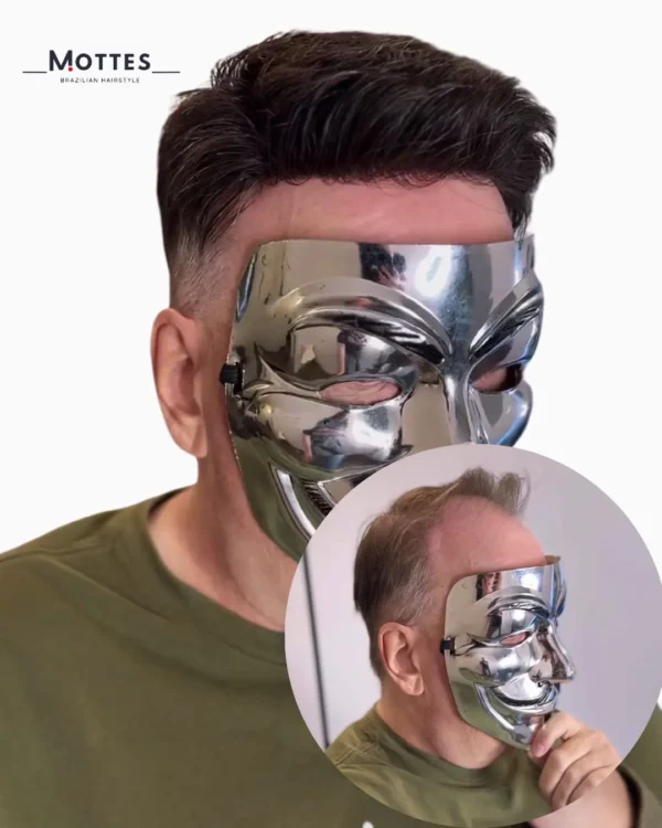 Custom Hair Prosthesis - Image 2