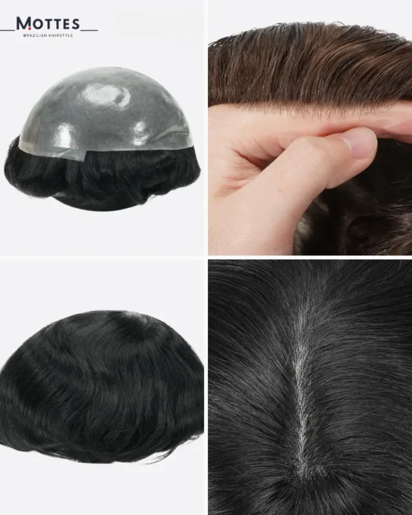 Hair Prosthesis